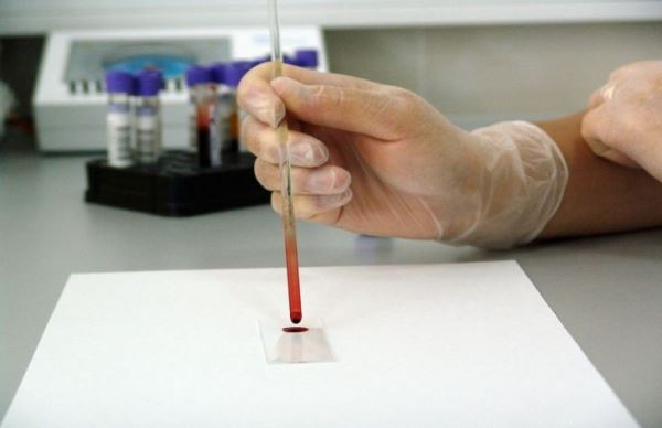 Как группа крови влияет на риск развития рака, выяснили ученые